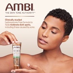 Ambi Even & Clear Fade Cream, Hydroquinone-free, Hyperpigmentation Treatment, Dark Spot Corrector, Results In As Little As 4 Weeks, Niacinamide, Aloe Vera, Vitamin C, 1 Fl Oz - Image 7